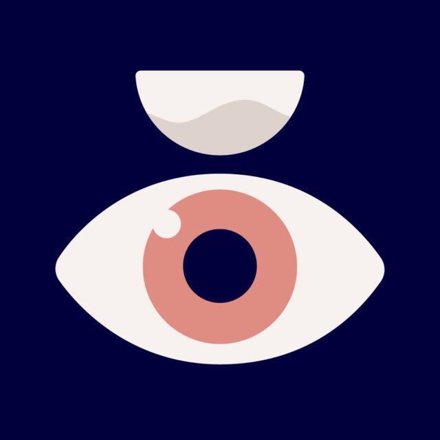 Illustration of a pink eye and a contact lens